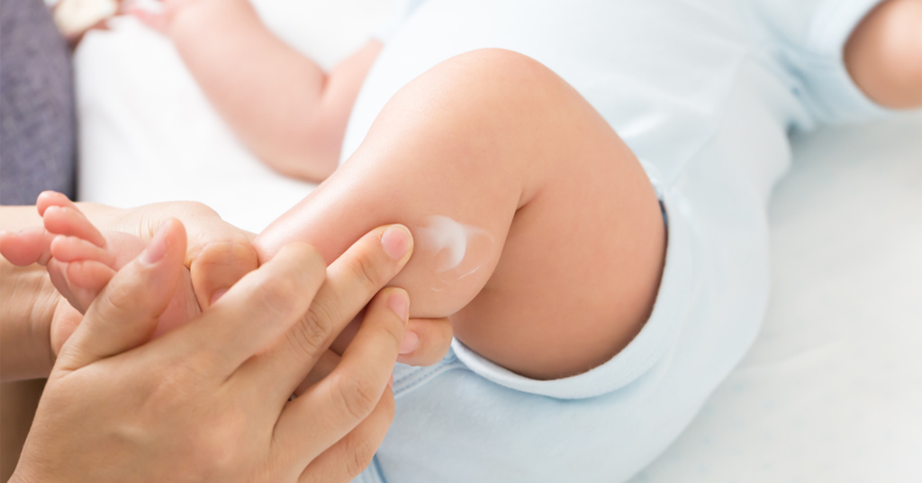 Baby Skin Care: Common Issues & Solutions