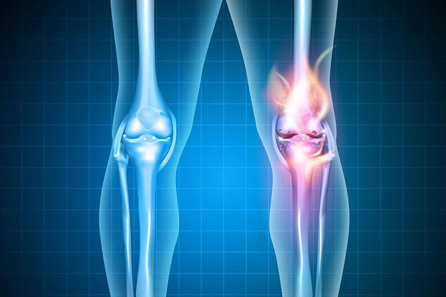 Symptoms Of Arthritis In The Knee