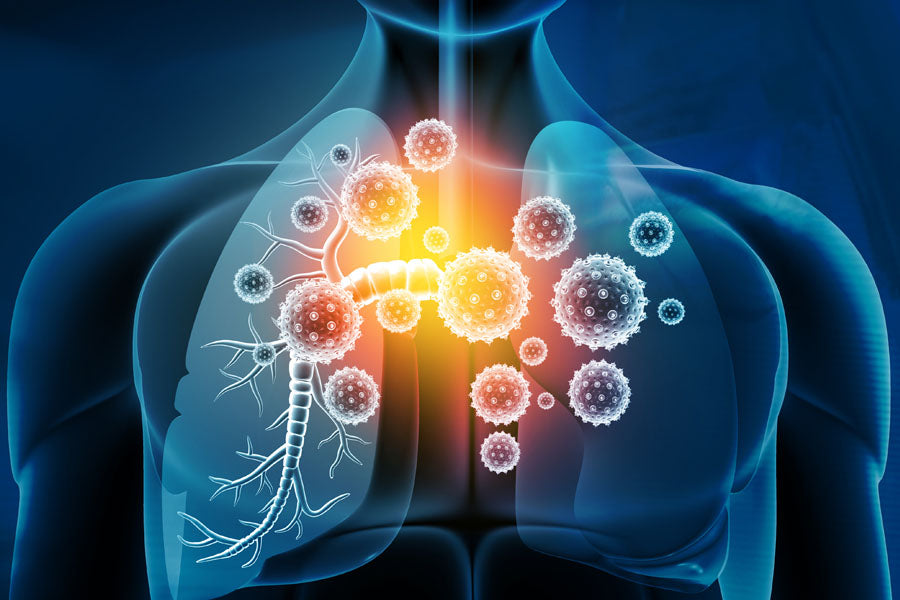 Asthma vs. Bronchitis: Know The Difference
